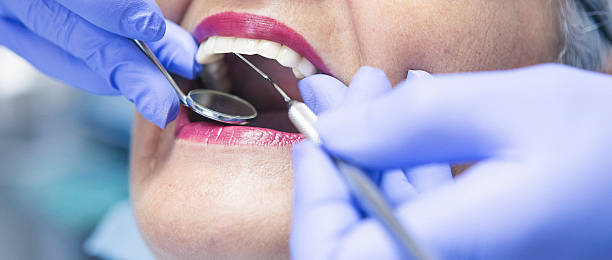Best Emergency Gum Treatment in Clinton, UT